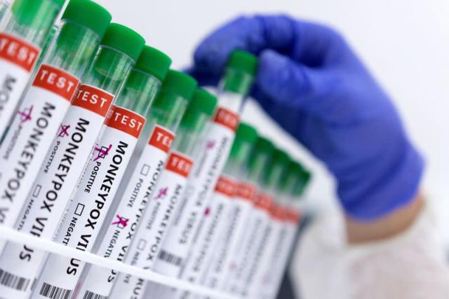 MINSA reporta siete nuevos casos de viruela símica