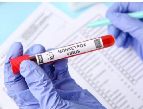 Aumentan a 16 los casos registrados de viruela símica en Panamá