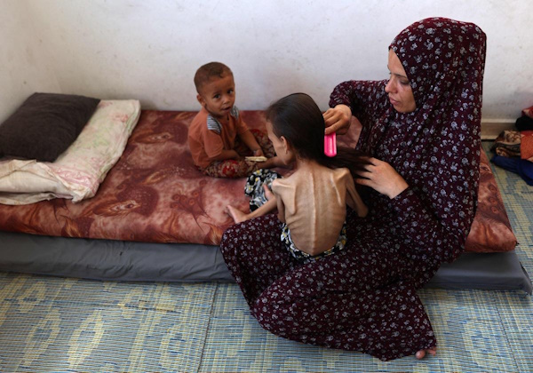 Al menos 453 gazatíes han muerto en la Franja de Gaza por la desnutrición y la hambruna en los casi dos años de ofensiva israelí, de los cuales 150 eran niños.