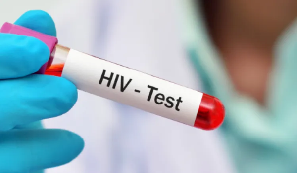 El 1 de diciembre marca el Día Mundial del VIH/Sida, una fecha que recuerda al mundo que esta epidemia, identificada por primera vez en 1981, continúa siendo un desafío global y también un problema de salud pública en Panamá. Aunque los avances médicos han transformado el pronóstico de quienes viven con el virus, las cifras más recientes confirman que la prevención, el diagnóstico temprano y el acceso al tratamiento siguen siendo fundamentales.