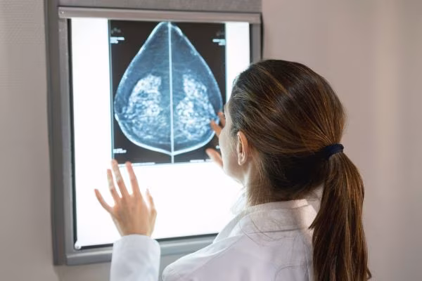 La mejor respuesta al cáncer es la detención temprana.